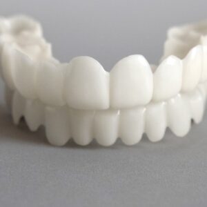 Snapon Smile nep tanden - boven en onder - Smile veneer - custom fit - wit gebit - witte tanden
